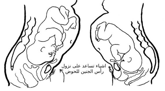اشياء تساعد على نزول رأس الجنين للحوض
